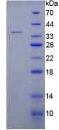Rat Complement C5a Protein (Recombinant His,N-terminus + GST)