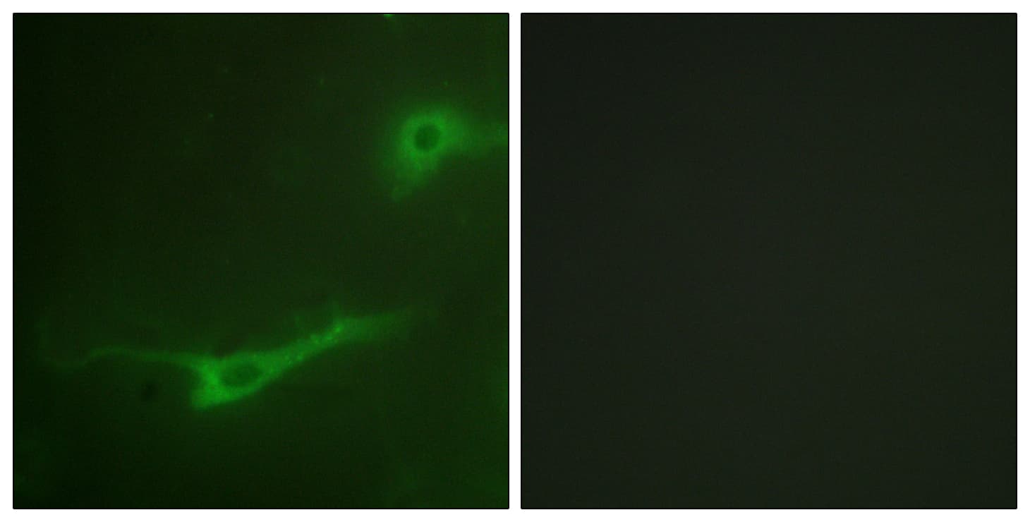 IHC-plus™ STXBP1 / MUNC18-1 Antibody (aa279-328)