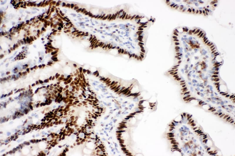Polyclonal Rabbit anti-Human CTBP2 Antibody (aa429-445, IHC, WB)