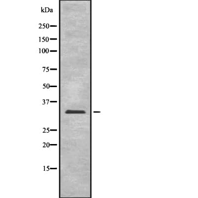 Polyclonal Rabbit anti-Human UCP2 Antibody (IHC, IF, WB)