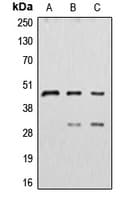 PathPlus™ CTSD / Cathepsin D Antibody (Internal)