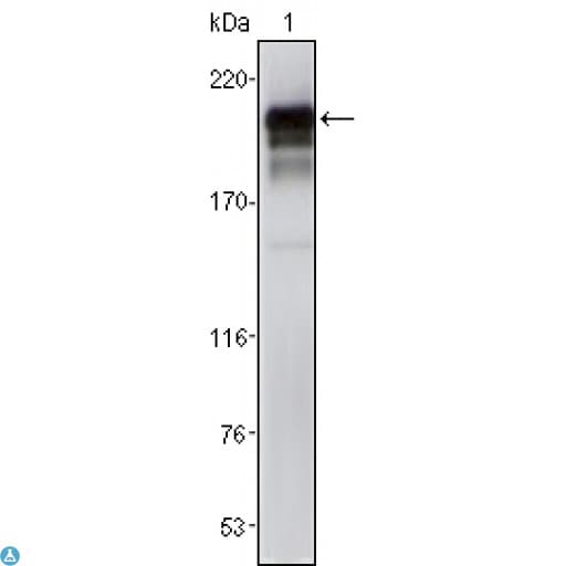 PDGFRB / PDGFR Beta Antibody