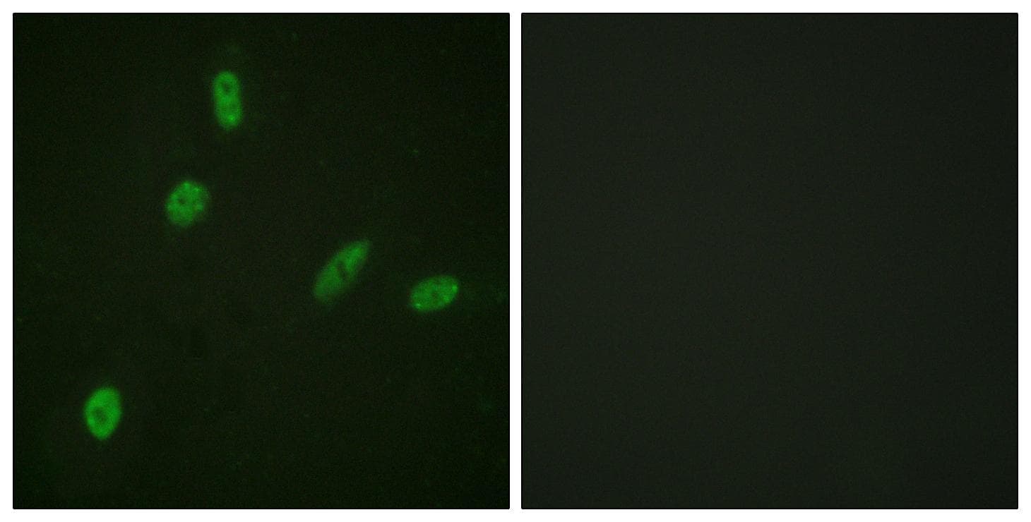 Polyclonal Rabbit anti-Human ETS1 / ETS-1 Antibody (p38, IHC, IF, WB)