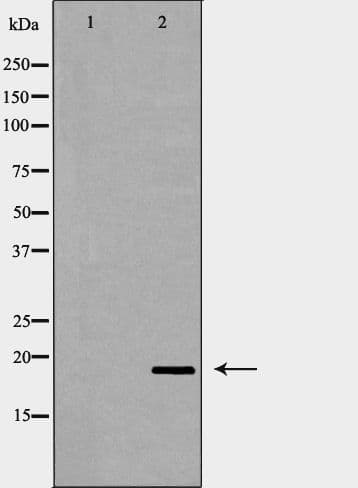 Polyclonal Rabbit anti-Human PTP4A3 Antibody (IHC, IF, WB)