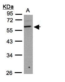 Polyclonal Rabbit anti-Human B3GNT3 / TMEM3 Antibody (aa122-338, IHC, WB)