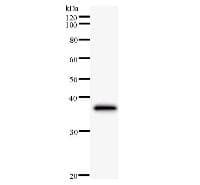 Monoclonal Mouse anti-Human CBLB Antibody (clone 246C5a, WB)