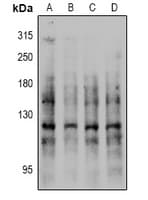 Polyclonal Rabbit anti-Human CDH1 / E Cadherin Antibody (WB)