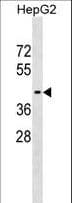ATG18 / WIPI1 Antibody (aa202-232)