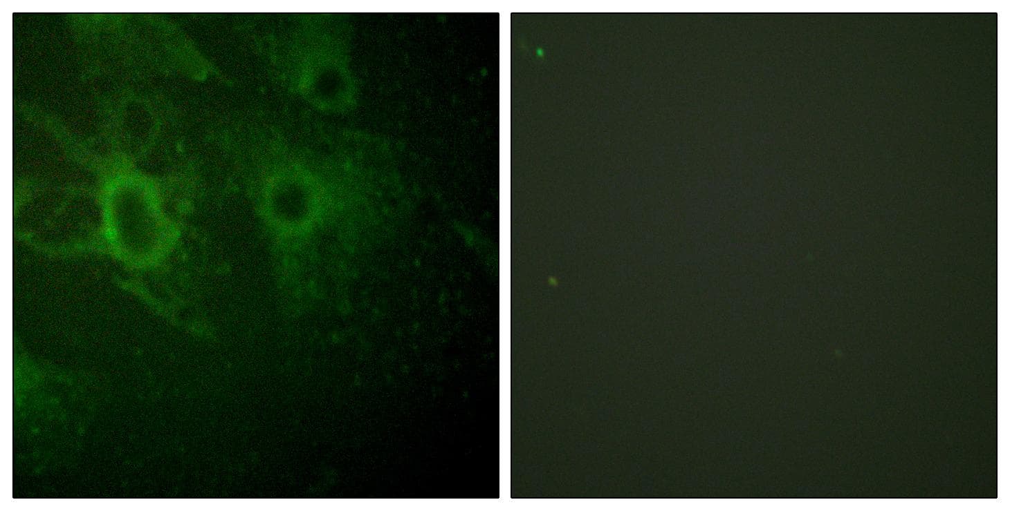 HCK Antibody (phospho-Tyr410)