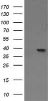 Monoclonal Mouse anti-Human MAP2K3 / MEK3 / MKK3 Antibody (clone OTI5C11, IF, WB)