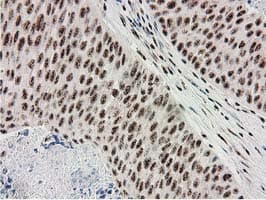 MGLL / Monoacylglycerol Lipase Antibody (clone OTI2B11)