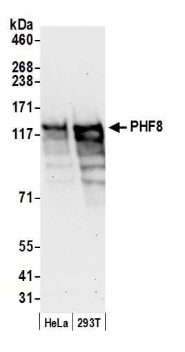 IHC-plus™ PHF8 Antibody (aa650-700)