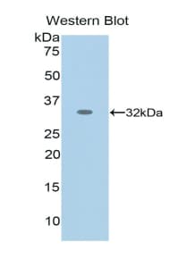 NES / Nestin Antibody