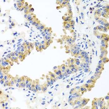 HSPA6 / HSP70B' Antibody