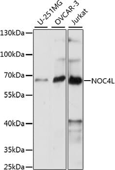 Polyclonal Rabbit anti-Human NOC4L Antibody (WB)