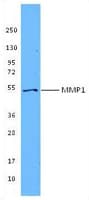 MMP1 Antibody (clone 3B6)