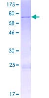 Human METT11D1 Protein (Recombinant GST)