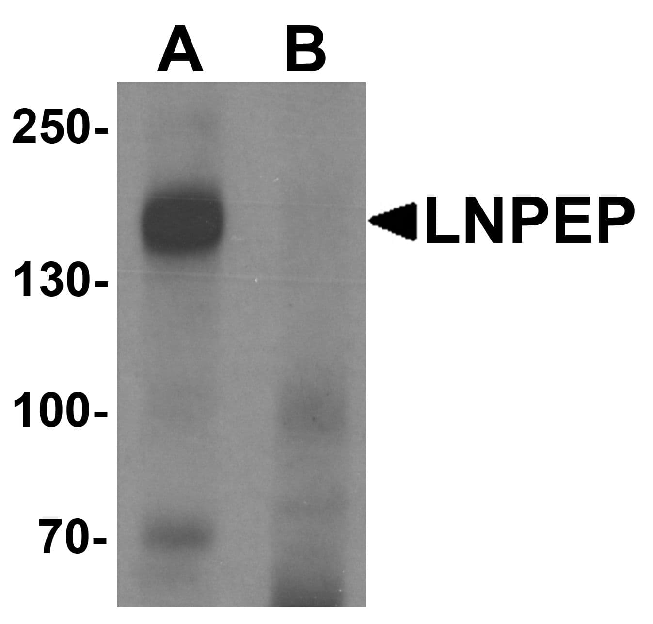 IHC-plus™ LNPEP Antibody