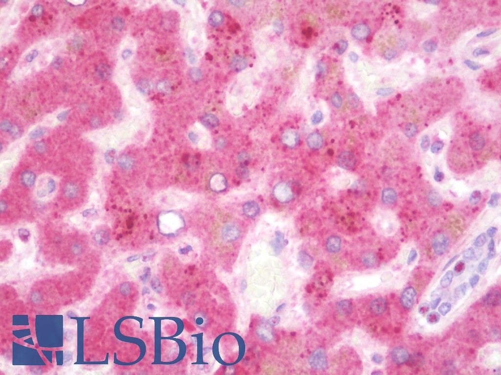 IHC-plus™ Polyclonal Rabbit anti-Human TMEM135 Antibody (IHC, IF, WB)