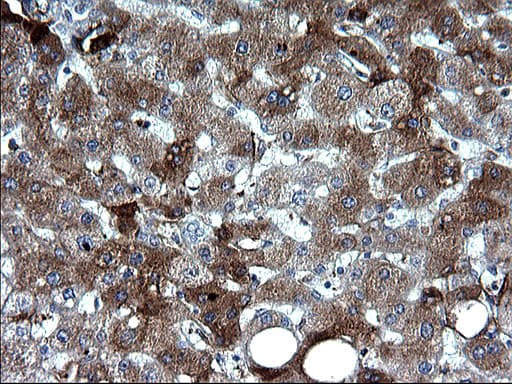 FGG / Fibrinogen Gamma Antibody (clone OTI4D3)