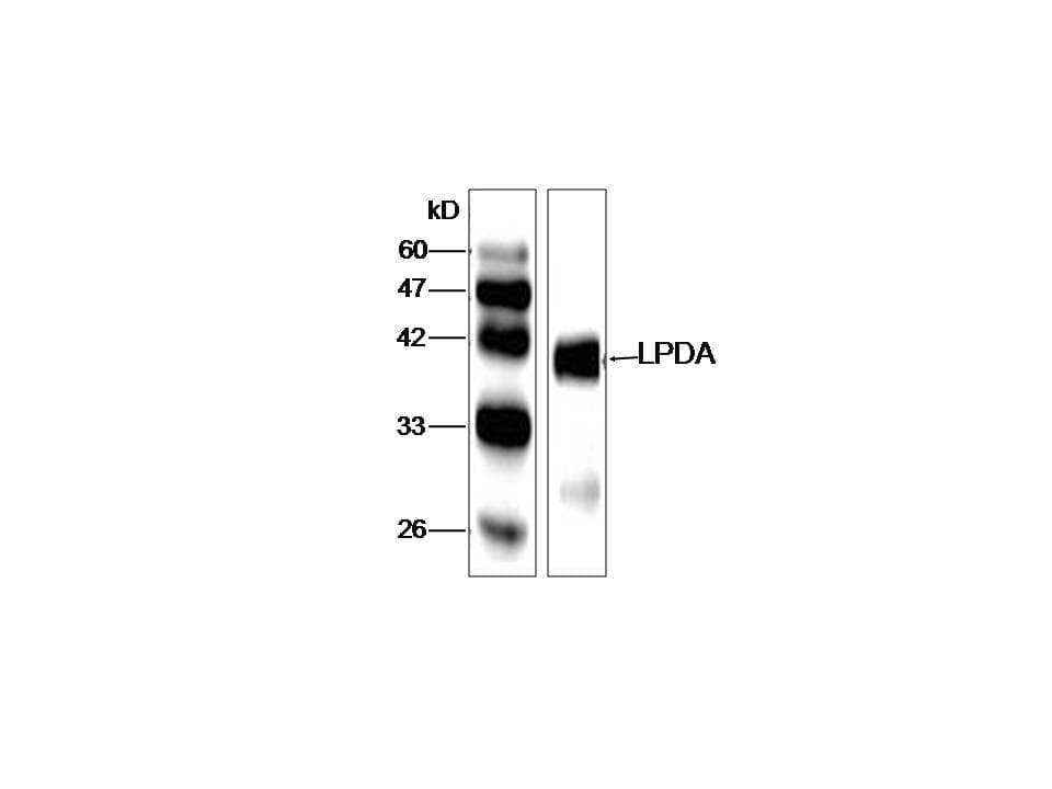 Neisseria meningitidis LPDA Antibody (aa332-469)