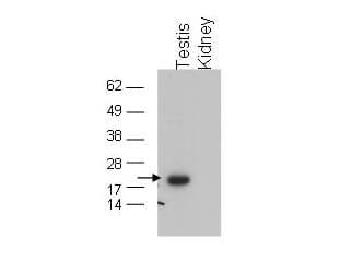 GPX4 / MCSP Antibody