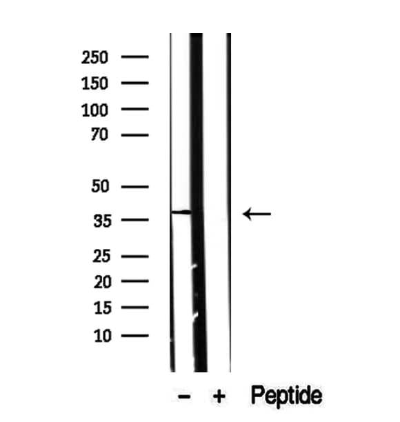 CXXC5 Antibody