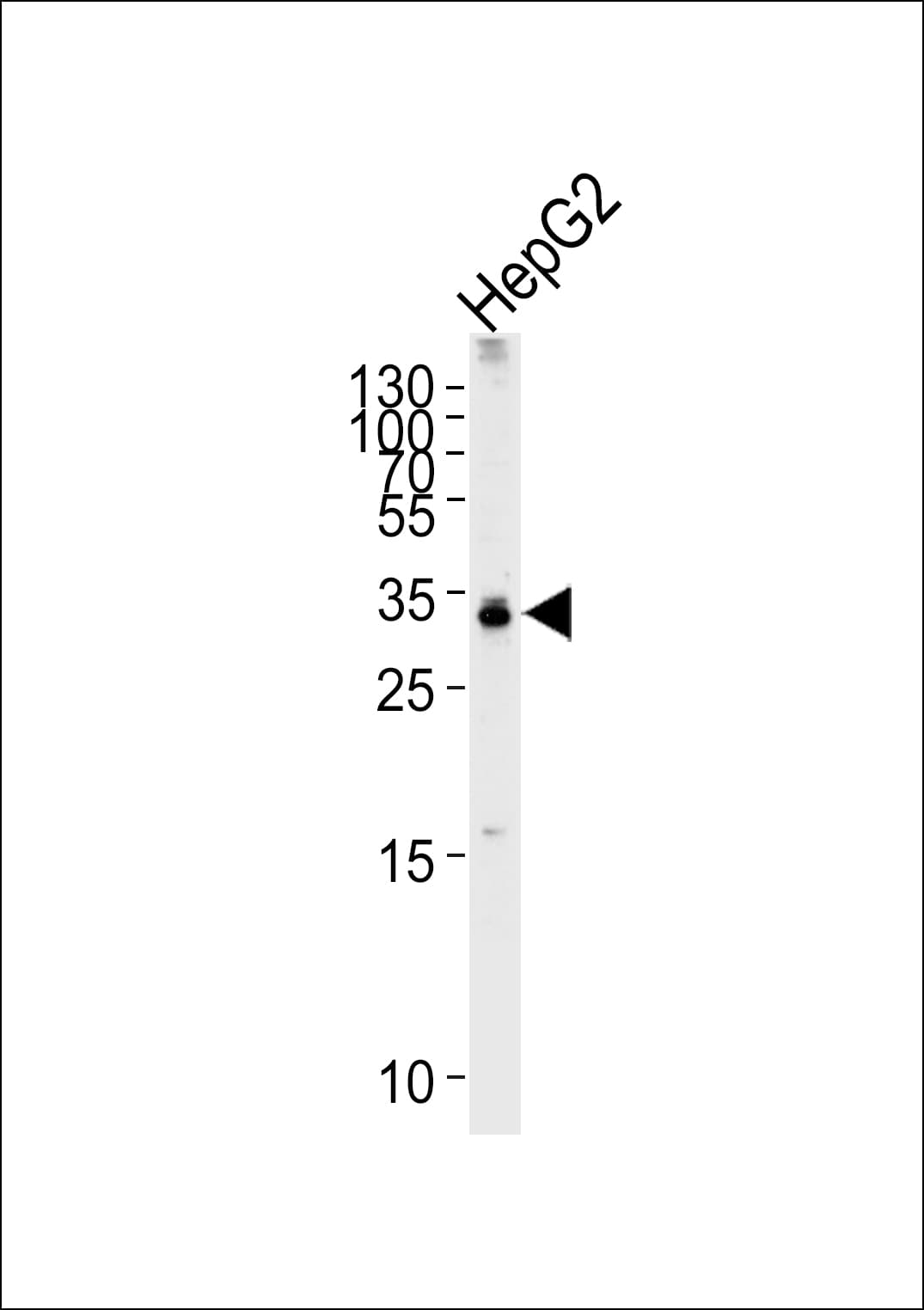 Polyclonal Rabbit anti-Human TCEAL2 Antibody (aa1-30, WB)