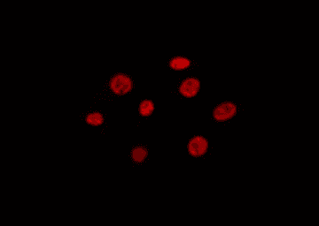 RANBP17 Antibody