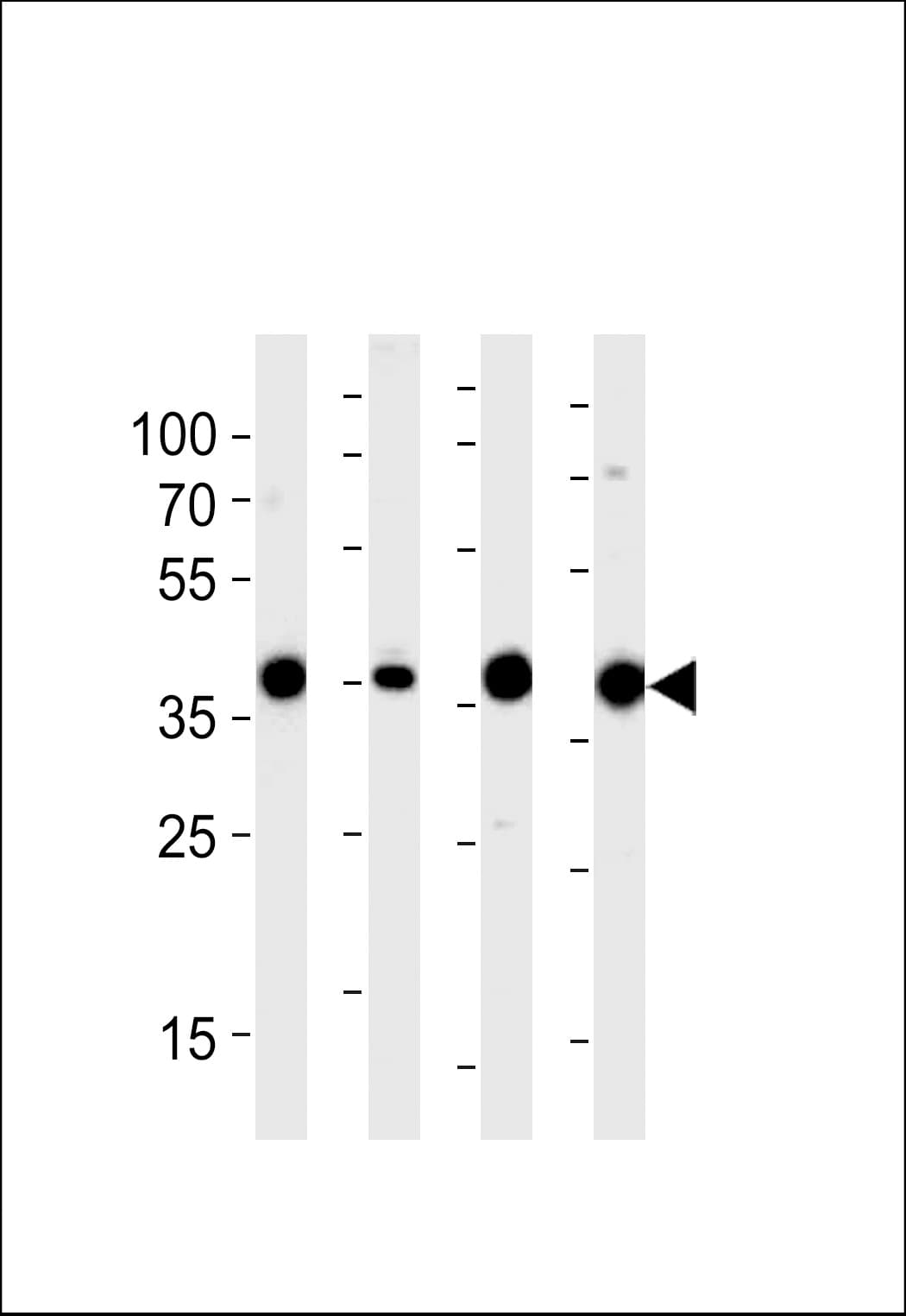 IHC-plus™ ALDOA / Aldolase A Antibody (aa66-95)