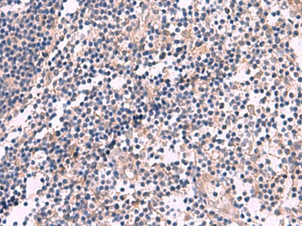 Polyclonal Rabbit anti-Human KCNN3 / SK3 Antibody (IHC)