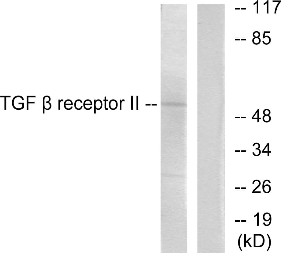 TGFBR2 Antibody (aa91-140)