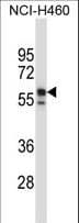 KRT6B / CK6B / Cytokeratin 6B Antibody (aa207-236)