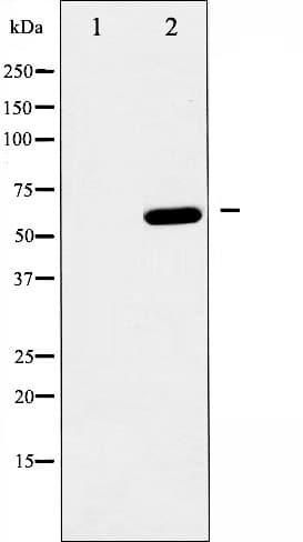 PRKAA1 / AMPK Alpha 1 Antibody (phospho-Ser485,pSer491)