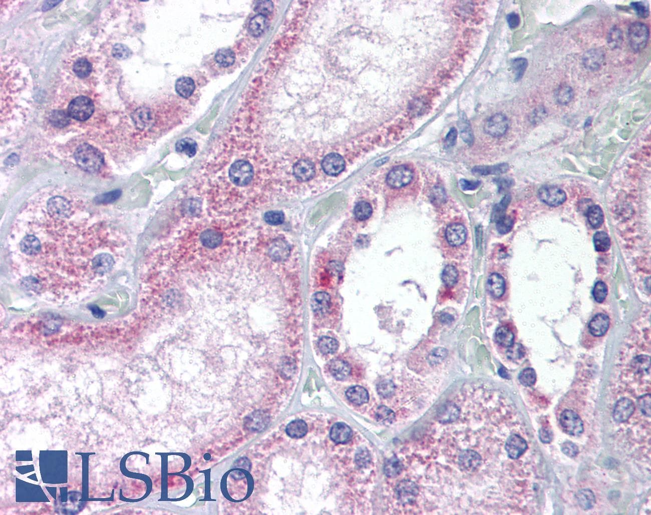 IHC-plus™ Polyclonal Rabbit anti-Human KATII / AADAT Antibody (Internal, IHC)