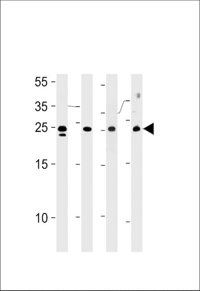 Polyclonal Rabbit anti-Human TSN / Translin Antibody (aa109-138, IHC, IF, WB)