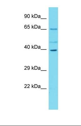 C16orf59 Antibody (aa85-134)