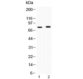 ACS5 / ACSL5 Antibody