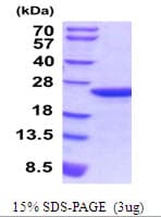 Mouse MLC2 / MYL9 Protein (Recombinant His)