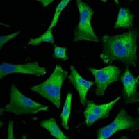 RELA / NFKB p65 Antibody