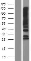 PTPN20 Protein (Over-Expression Lysate Myc-DDK (Flag))