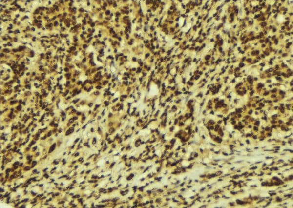 REL / C-Rel Antibody