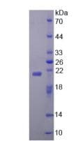 Human ZBP1 Protein (Recombinant His, N-Terminal)