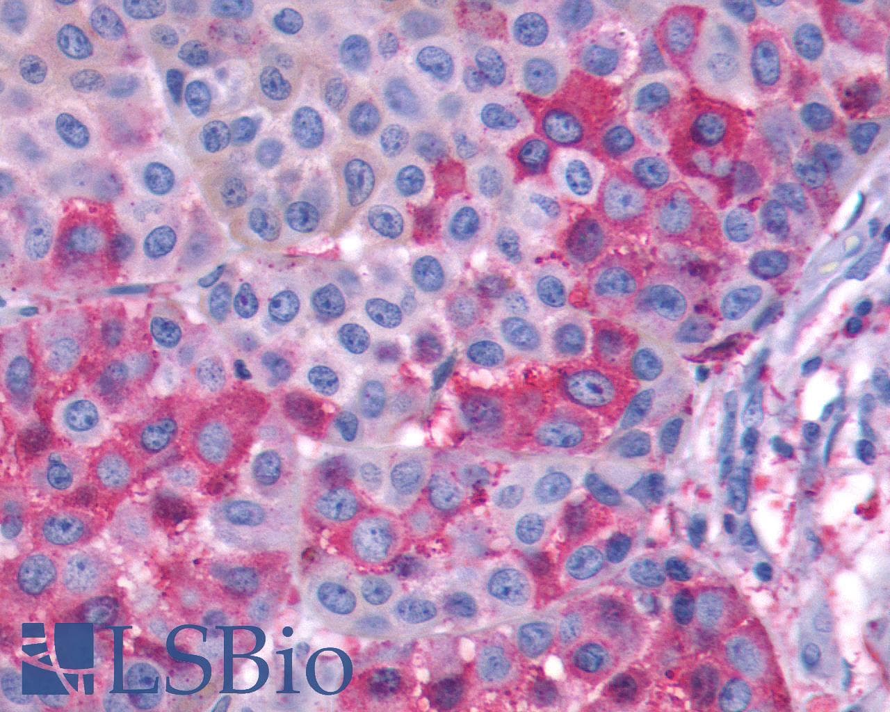 PathPlus™ GPR143 Antibody (C-Terminus)