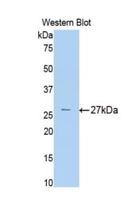 A2M / Alpha-2-Macroglobulin Antibody (aa216-437)