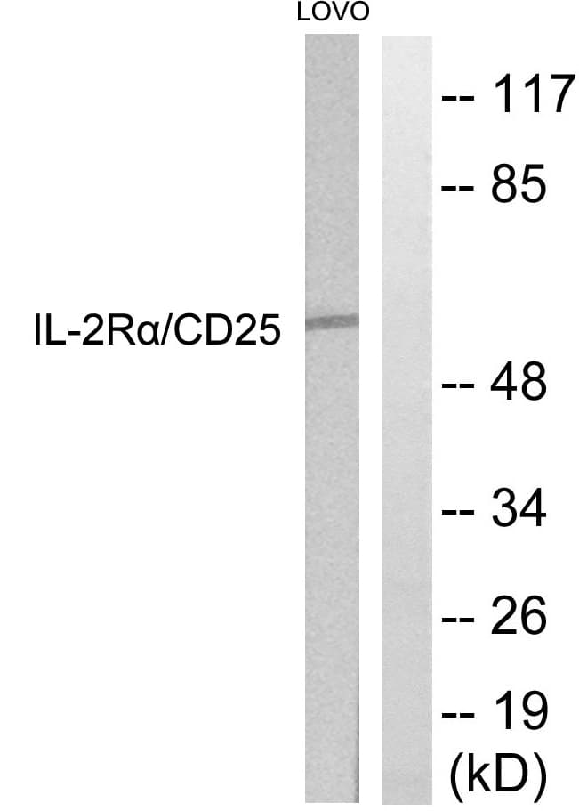 IL2RA / CD25 Antibody (aa223-272)