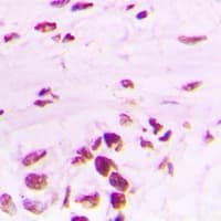 PLK1 / PLK-1 Antibody (phospho-Thr210)