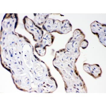 COMT Antibody (aa52-271)