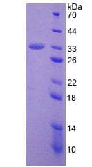 Human ADAM28 Protein (Recombinant His, N-Terminal)