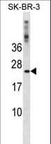 Polyclonal Rabbit anti-Human FXN / Frataxin Antibody (aa36-64, WB)